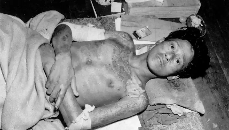 80 Yıl Sonra Nagasaki’den Korkutucu Uyarı: Nükleer Felaket Günü Yaklaşıyor