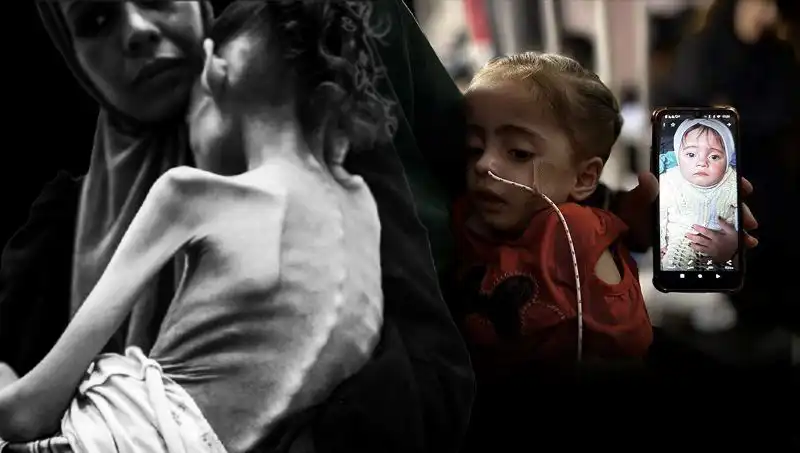 Küçük Meryem'in Mücadelesi: 25 Kilo ile 10 Kilo Arasında Kalan Bir Hayat
